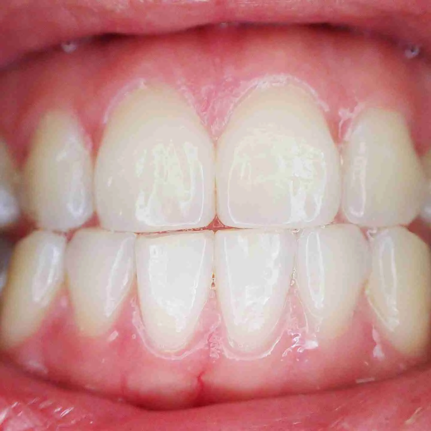 teeth 887338 1920 edited